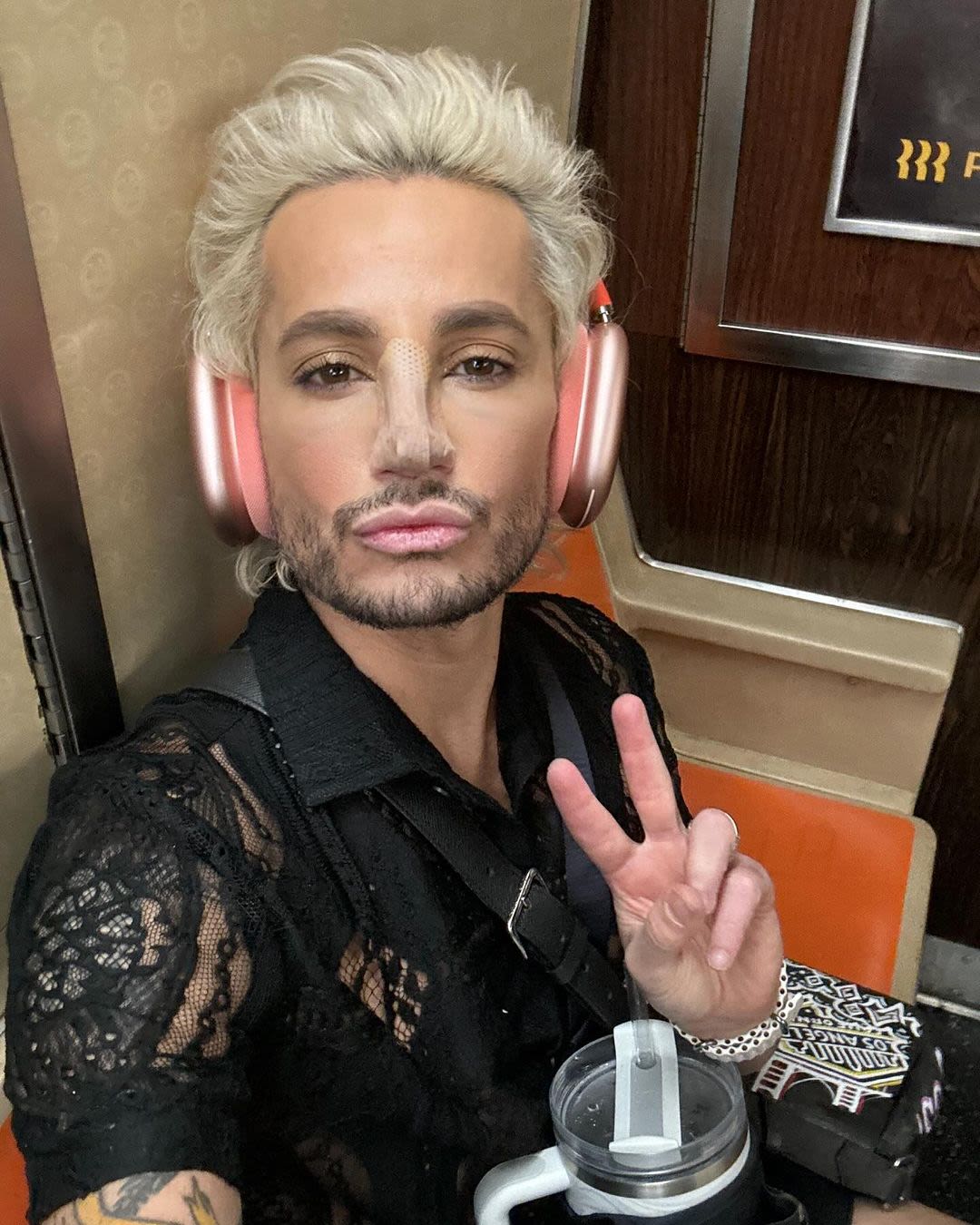 Ariana Grande’s Brother Frankie Debuts ‘New Nose’ in Public After Plastic Surgery: Photos