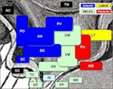 Ventromedial nucleus of the hypothalamus