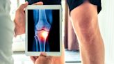 Single stem cell injection repairs knee cartilage, cuts pain by 58%