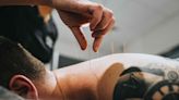 Can Acupuncture Treat Your Pain?