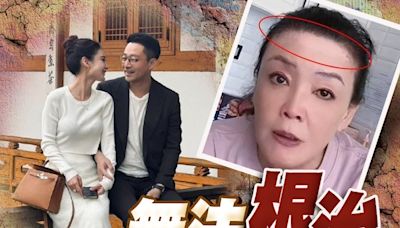 汪小菲新老婆過門僅一周 張蘭忽然驚爆患不治之症