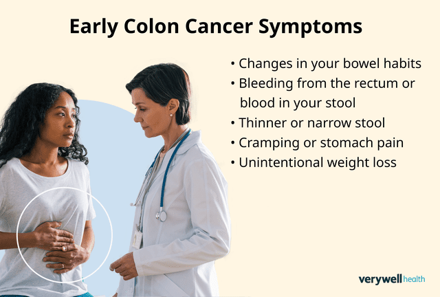 Symptoms That May Signal Early Colon Cancer