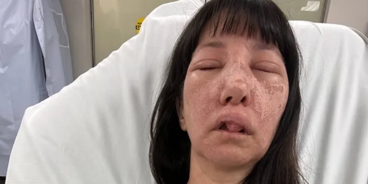 ‘A lot of pain’: Woman survives several brown recluse spider bites