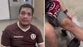 Hincha de Universitario fue agredido por la policía de Brasil tras el duelo ante Botafogo por la Copa Libertadores 2024