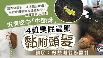 臭屁蟲︱港男家中「中頭獎」頭髮黏附14粒臭屁蟲卵 網民：好靚嘅髮飾設計