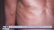 DC identifies at-risk groups for Monkeypox vaccine