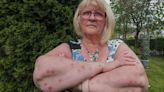 TUI under fire as Marjorie, 66, left looking like this