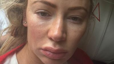 Olivia Attwood shares her tired makeup free selfie
