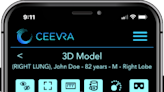 Ceevra Receives EU MDR Certification for its Surgi | Newswise