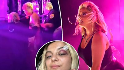 Bebe Rexha boots fan for hurling object at her 1 year after phone-throwing incident left her with black eye