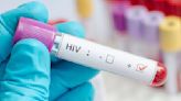 Reglamentaron la ley de respuesta integral para personas con VIH y hepatitis virales