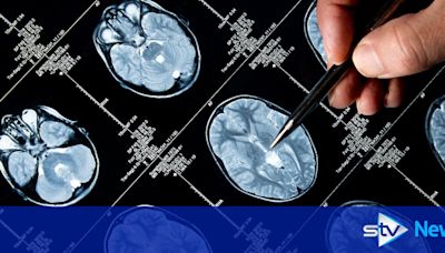 Scots hub announces Alzheimer's firm as first tenant after £20m award