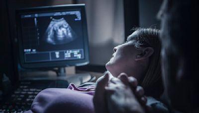 Medical residents are increasingly avoiding states with abortion restrictions