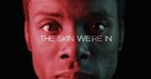 The Skin We're In (film)