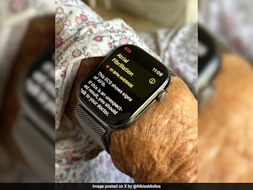 Apple Watch's ECG Feature Helps Save Elderly Woman By Detecting Irregular Heartbeat In US