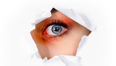 ¿Cómo saber si un golpe en un ojo es grave? Estos son los daños que puede ocasiona a tu vista