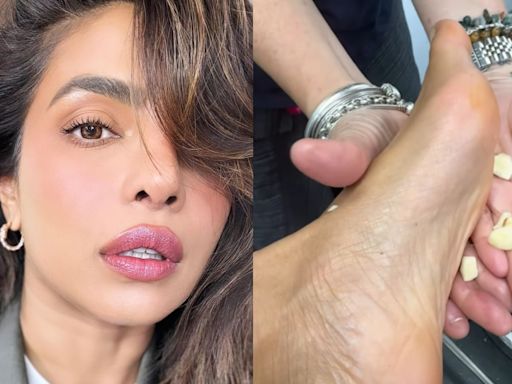 Priyanka Chopra Jonas rubs garlic on her feet: What are the benefits of this desi nuskha?