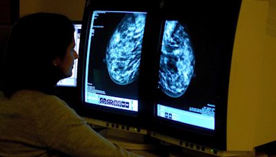 Breast cancer drug not recommended for NHS use after price talks break down