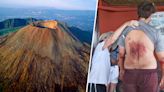 Tourist, 23, Injured After Falling Into Mount Vesuvius Crater While Taking Selfie