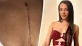 Beauty pageant contestant refuses to cover up her scar and says ‘it is who I am’