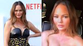 Chrissy Teigen Shares Clip of Her 'Anxiety Hives' Ahead of Red Carpet Appearance: 'Every Event'