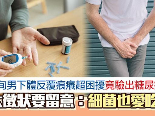 5旬男下體反覆痕癢竟驗出糖尿病 6大徵狀要留意：細菌也愛吃甜