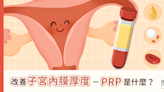 【陳俊凱醫師】改善子宮內膜厚度－PRP是什麼？