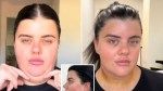 Millennial trolled online for revealing she had cosmetic surgery done