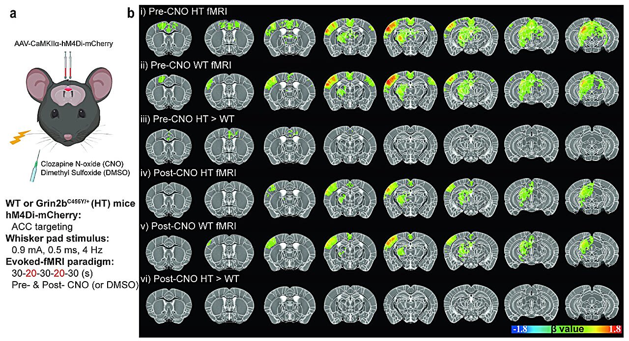 Study identifies primary cause of sensory hypersensitivity in a mouse model of autism spectrum disorder