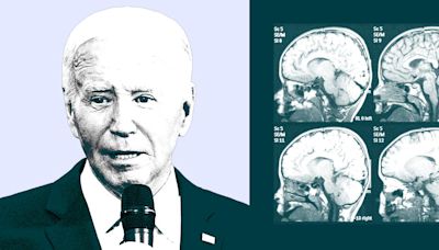 A brain expert explains the cognitive test used to assess a president's mental fitness. It's not easy.