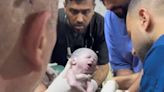 Baby in Gaza saved from womb of mother killed in Israeli strike