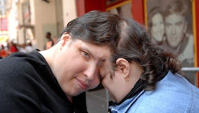 World’s oldest conjoined twins, Lori and George Schappell, die at age 62 in Pennsylvania