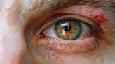 Este es el síntoma ocular poco conocido que puede indicar la presencia de diabetes