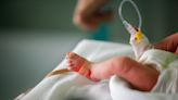 You Can Do Everything 'Right' and Still Have a Preterm Birth