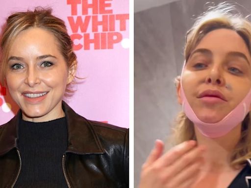Jenny Mollen Shows Off Body Before Going Under the Knife for Numerous Plastic Surgery Procedures: Photos