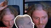 Streamer en TWITCH se rasura la cabeza en vivo y se encuentra hendidura en su cabeza por culpa de sus audífonos