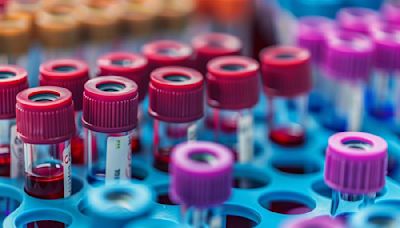 Blood Test Predicts Multiple Sclerosis Years Before Symptoms Appear - Neuroscience News