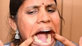 Look: Indian woman with 38 teeth earns Guinness World Record