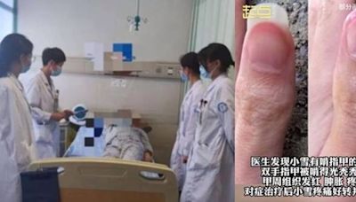 浙江14歲女常咬手引關節炎敗血症！醫警告：長期嚴重危害健康