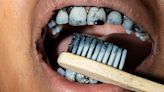 The Best and Worst Habits for Your Teeth