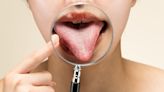 ¿Qué nos dice la lengua sobre nuestra salud? Si la tienes de este color debes acudir al médico