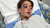 I'm sharing upsetting pic of son after driver ploughed into him 'in revenge'