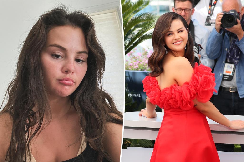 Selena Gomez reveals which cosmetic procedure she’s had done after fan speculation