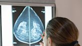 Doctors are better at detecting breast cancer when they get help from AI, large study finds