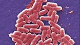 E coli outbreak warning for UK as more than 100 cases linked to food