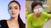 Jasmin Bhasin Is 'Feeling Worst' Due To Corneal Damage, Talks About 'Excruciating Pain and No Vision' - News18