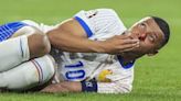 Kylian Mbappé evitará la cirugía de nariz tras fractura ante Austria