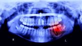 Humans May Be Able to Grow New Teeth Within Just 6 Years