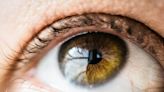 Cirugía para cambiarse el color de los ojos: cuánto cuesta en Colombia y qué riesgos tiene
