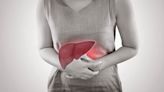 降膽固醇藥物會傷肝？醫揭「世紀大冤案」：不會傷肝、還能預防脂肪肝